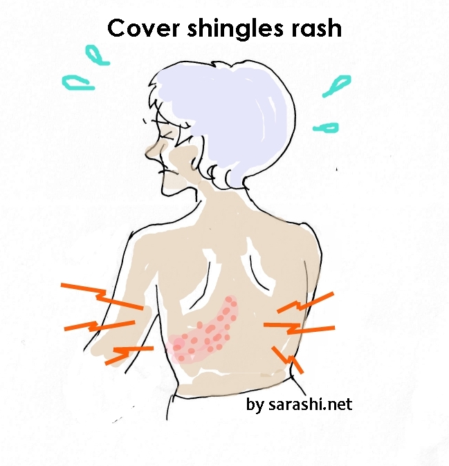 Cover shingles rash by Sarashi, protect affected area wide cotton bandage